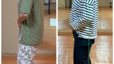 頑固な猫背も矯正成功！